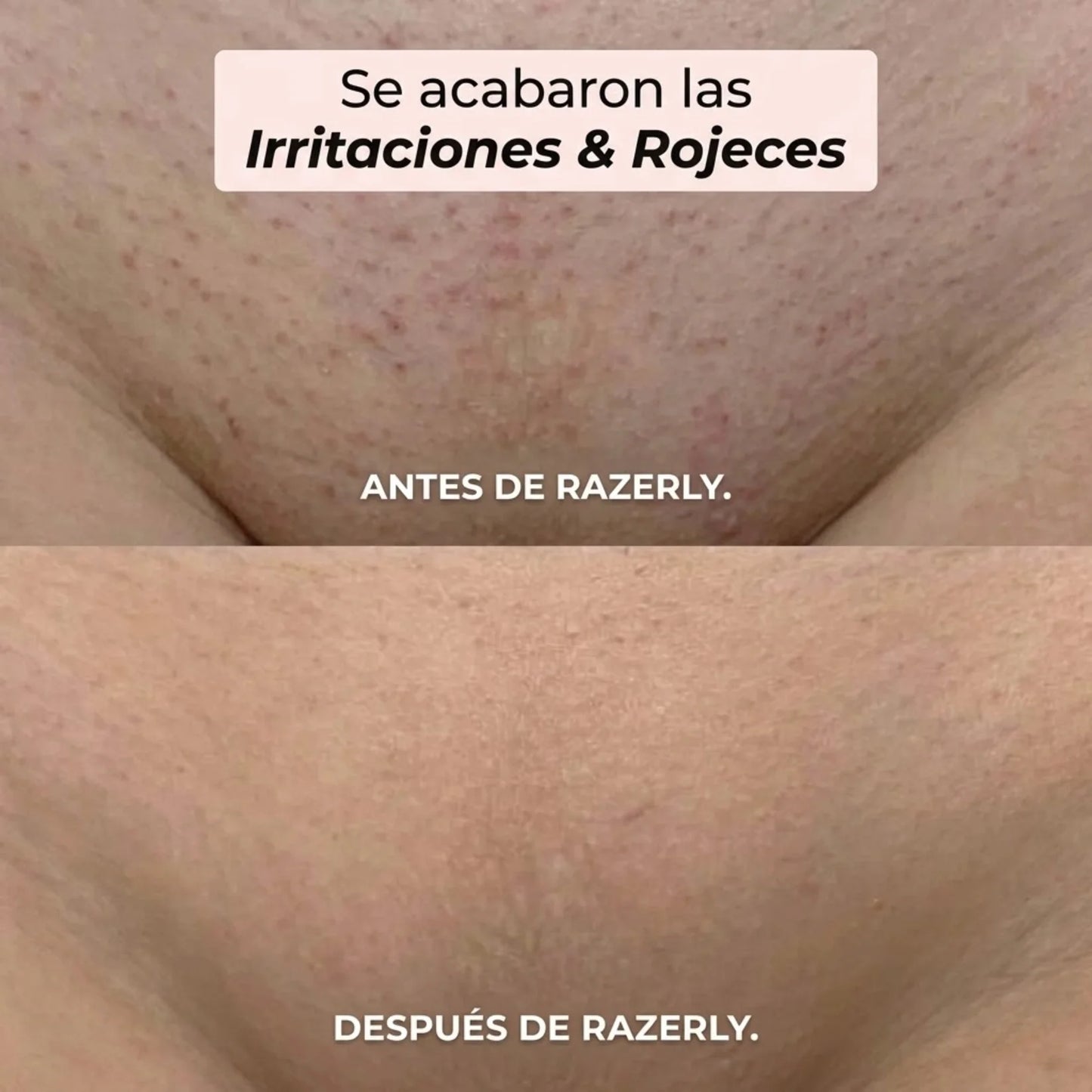 Maquinilla 2 en 1 para Bikini y Cuerpo Razerly™