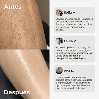 Maquinilla 2 en 1 para Bikini y Cuerpo Razerly™